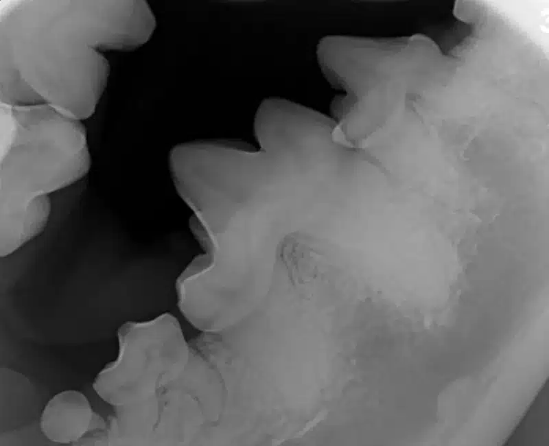 AAD-What-is-the-cause_- Digital Dental Radiography